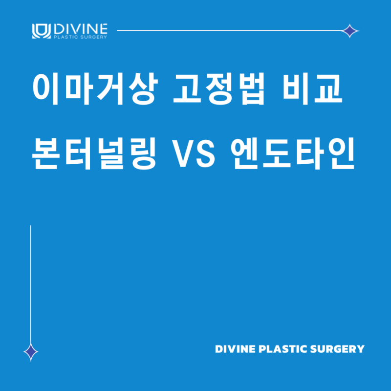 이마거상 고정법 비교 : 본터널링 vs 엔도타인