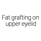 Fat grafting on upper eyelid