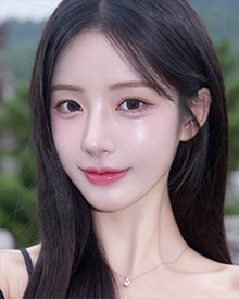 이마 눈매교정 후기