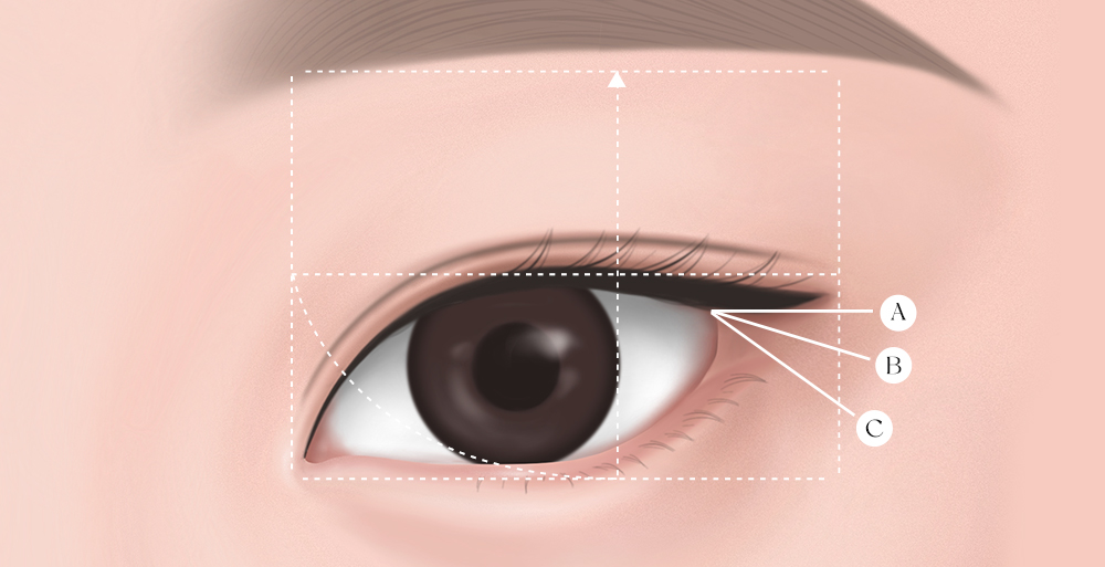 눈꼬리 재배치 A, B, C 타입 방향 설명 다이어그램